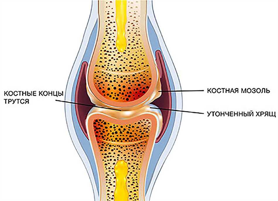 2. Отек и кровоизлияния