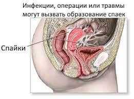 3. Правильное питание