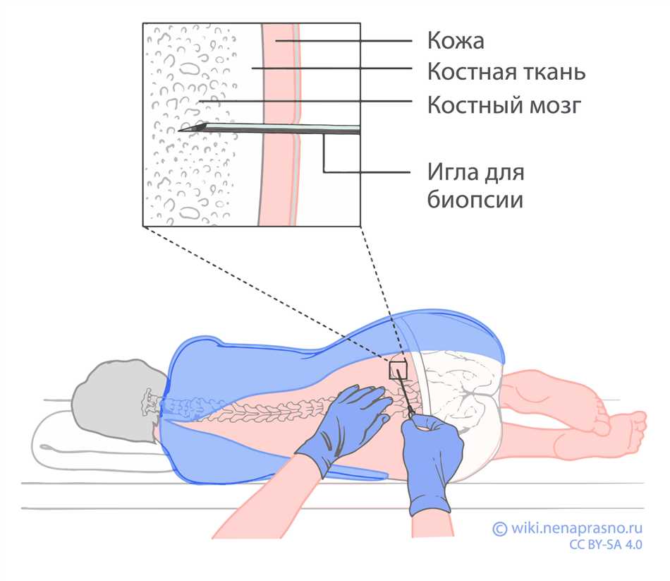 Процесс образования спинномозговой жидкости