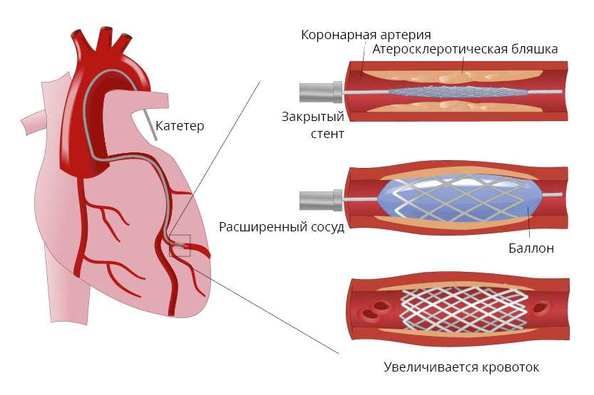 6. Прием лекарств