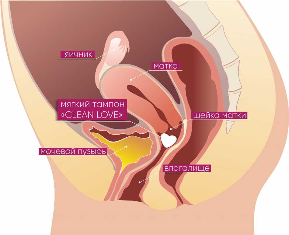 Что такое тампон и как его использовать