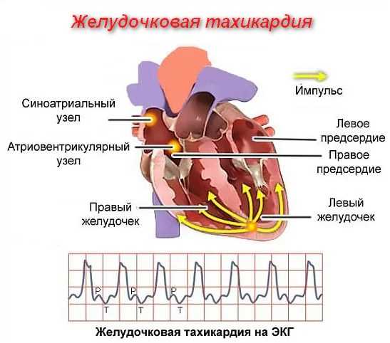 Народные средства лечения тахикардии