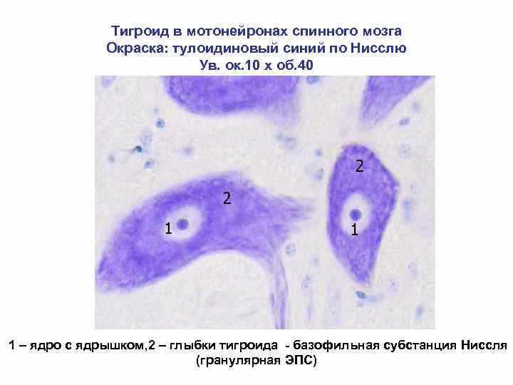 Тигроид в нервной клетке