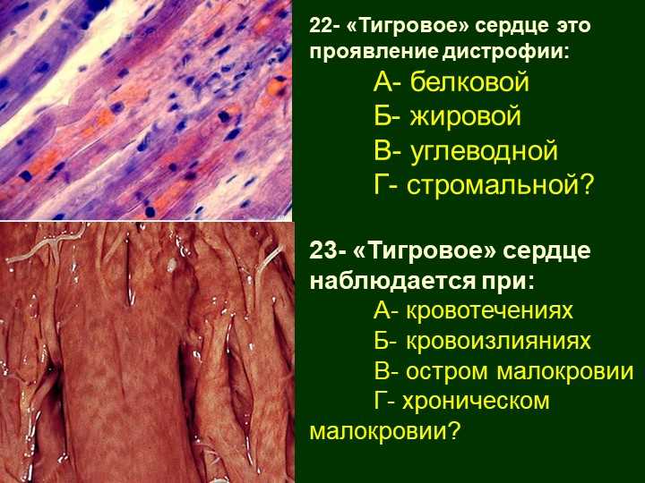 Тигровое сердце: что это такое?