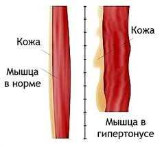 3. Психоэмоциональное состояние