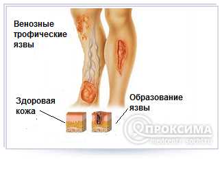 Структура трофика слизистой