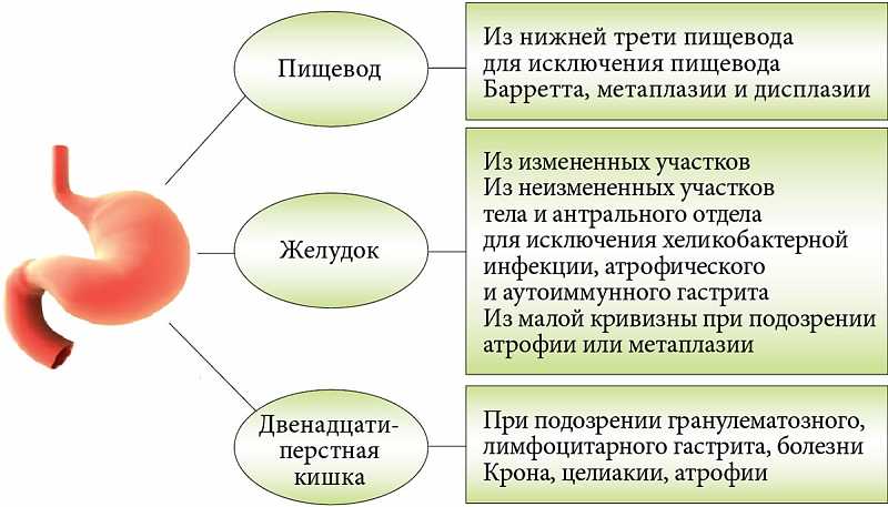 Профилактика значительного снижения желудка