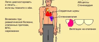 Почему сердце может чесаться: причины и рекомендации