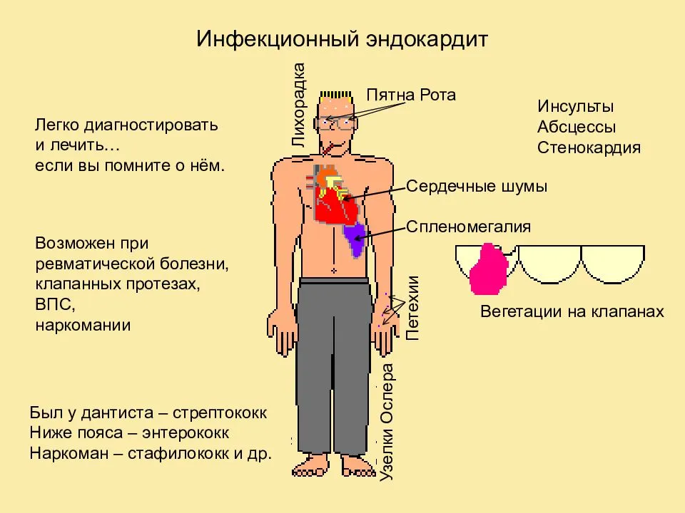 Что значит, если сердце чешется?