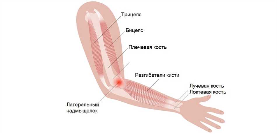 Локоть с другой стороны как называется