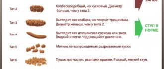 Что считается нормой для стула у взрослого в течение дня?