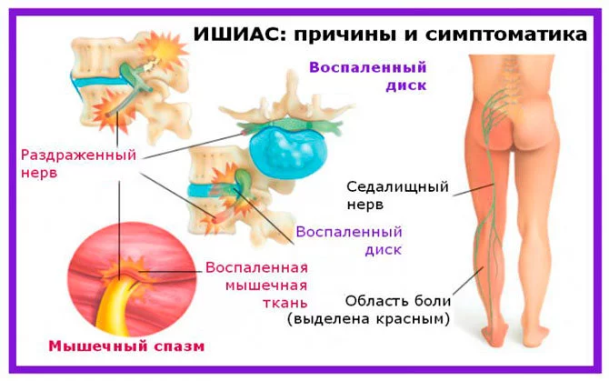 2. Профилактика тромбоэмболических осложнений