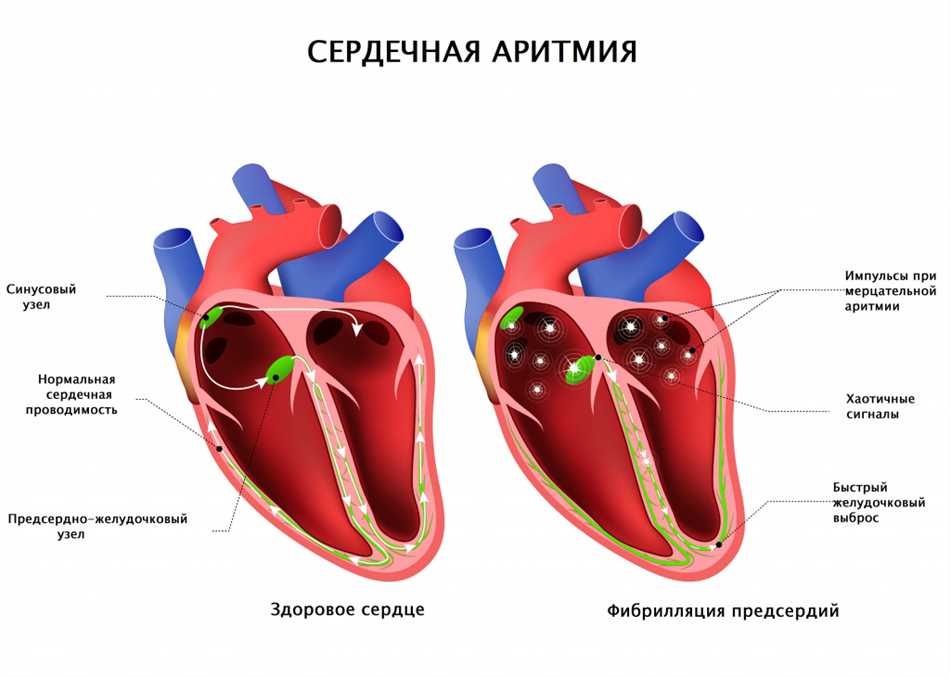 Причины бульканья в сердце