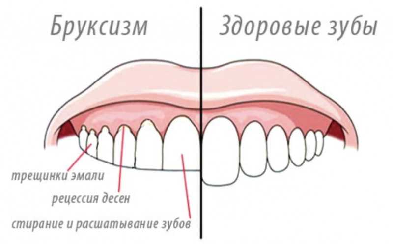 Почему поросята падают на ноги? | Статьи ООО Укрвет