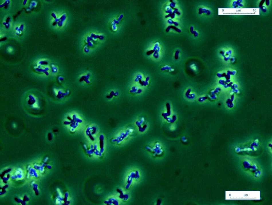 Propionibacterium freudenreichii: что это такое