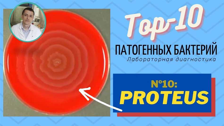 Proteus spp: что это такое и какие они опасны для человека?