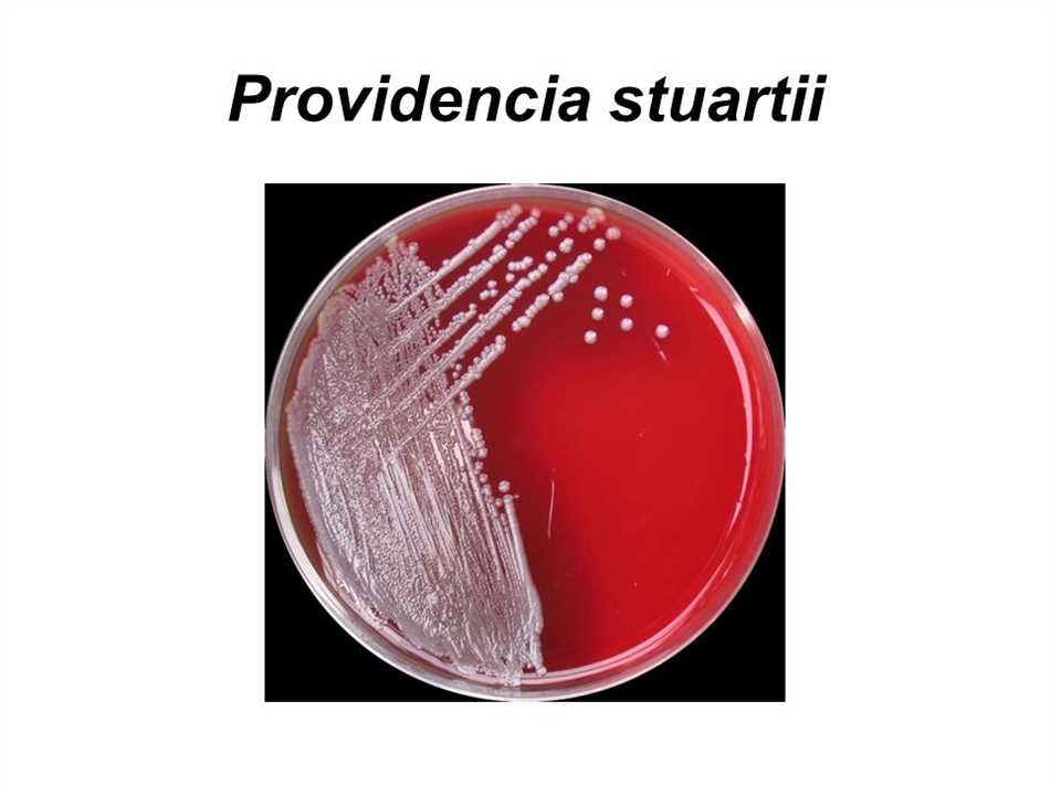 Providencia stuartii: что это такое?