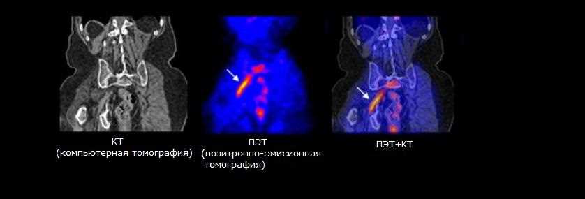 Технические аспекты применения РФП при ПЭТ-КТ