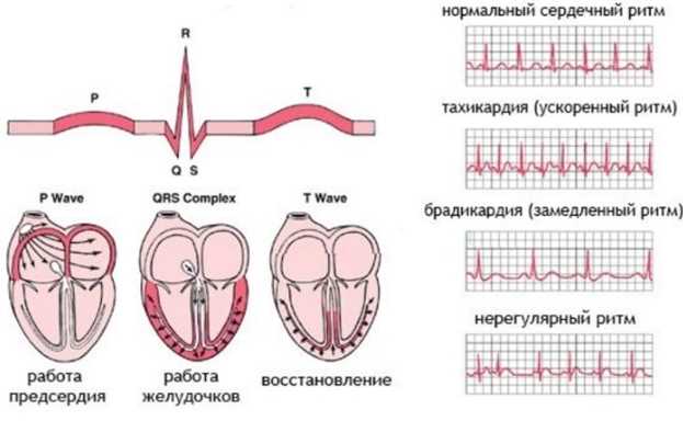 Ритм синусовой нормокардии: что это такое?