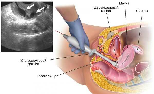 1. Генетическая предрасположенность