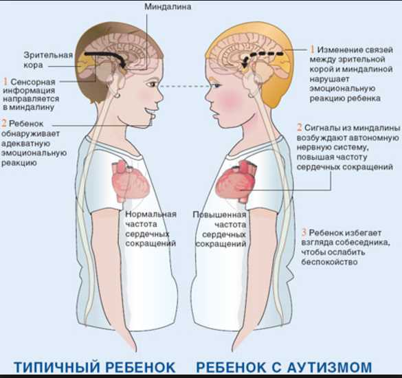 Роптизм у детей: что это такое и как его понять