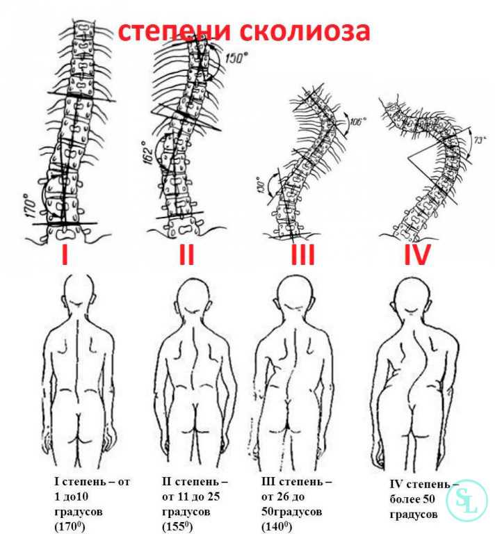 Ротация тел позвонков поясничного отдела: что это такое