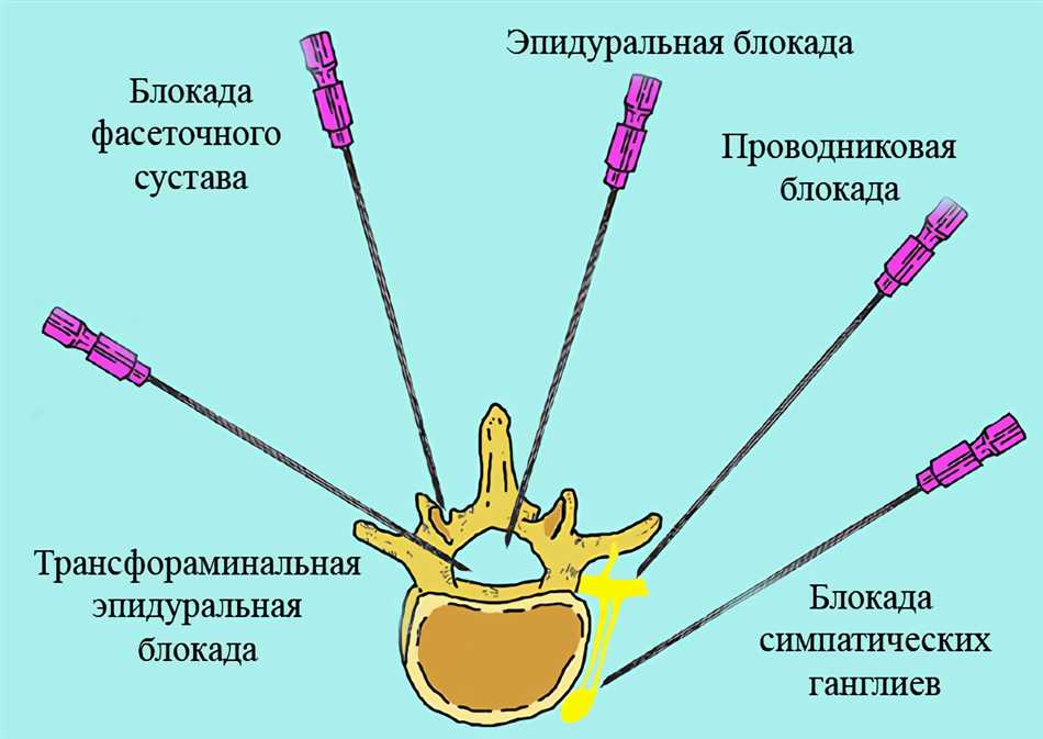 Какие могут быть побочные эффекты и осложнения?