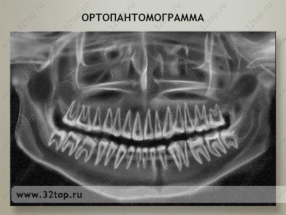 Причины применения сепарации